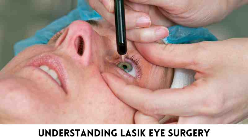 Understanding LASIK Eye Surgery